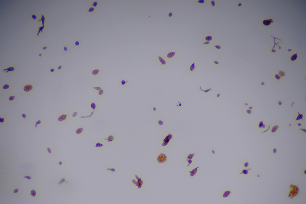 植物病害孢子圖片 植物病害孢子圖片